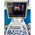 trolley color doppler ultrasound & doppler ultrasound machine with 4D volume probe